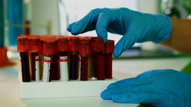 Lab med blodprover